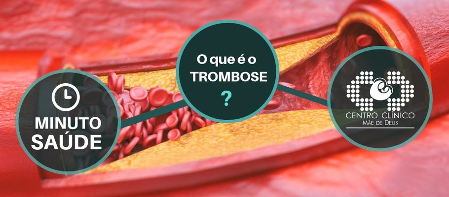 Coágulo como sangue dissolver perna de na
